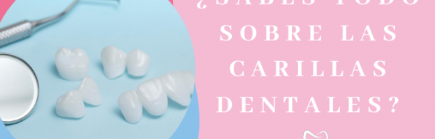 ¿Sabes todo sobre las carillas dentales?